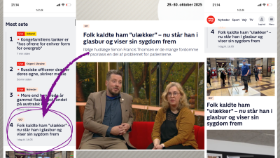 Presseklip udklip af TV2 Go'Morgen Danmark historier 29.-30. oktober Verdens Psoriasisdag 2025