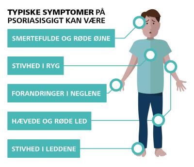 test psoriasisgigt