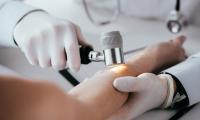 En hudlæge undersøger huden på en patients arm med et dermatoskop med lys, ingen ansigter synlige på billedet.