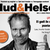 Forsiden af magasinet Hud & Helse nummer 1 2026 - overskrifter på udvalgte artikler på baggrund af portræt af Lasse Spang Olsen